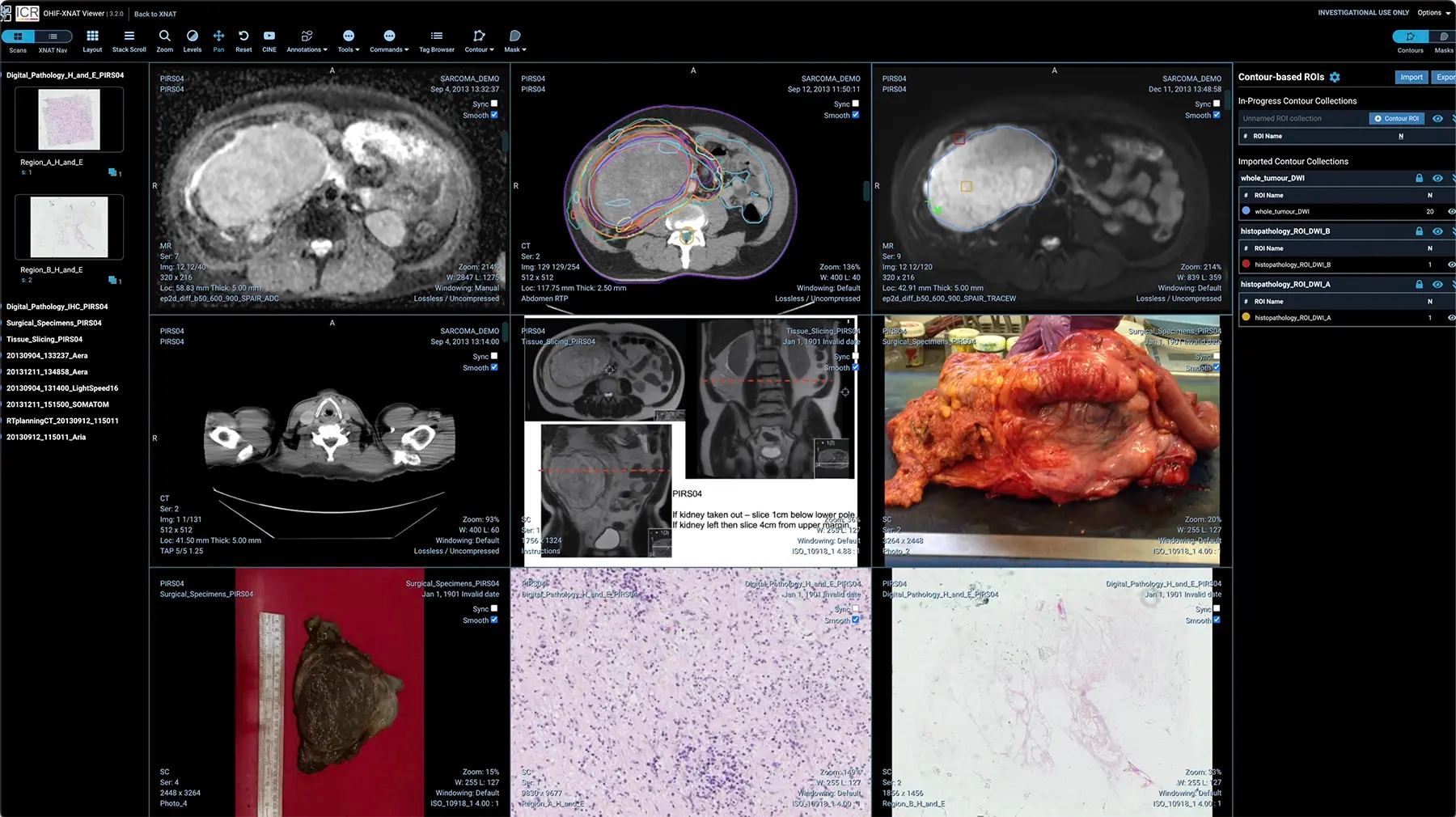 Imagerie médicale avancée