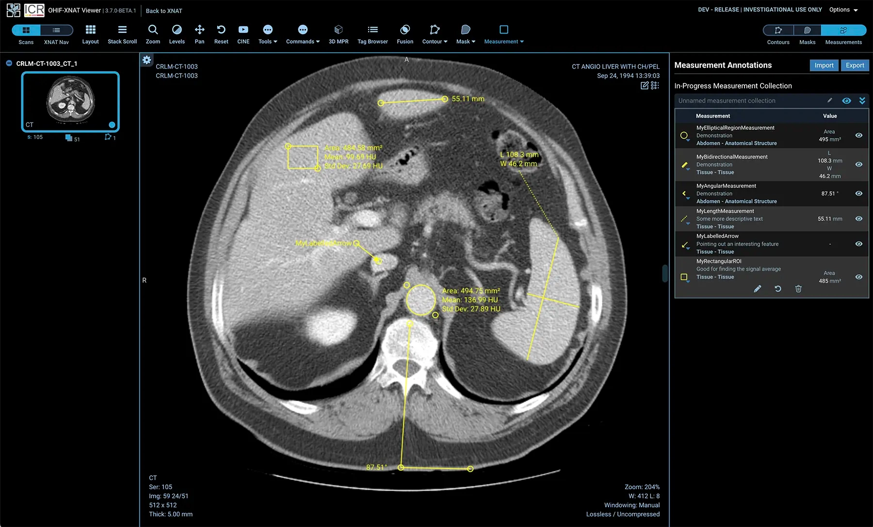 DICOM visualization 2